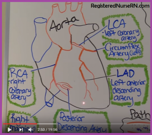 Coronary Artery Disease Part 1 NCLEX Review
