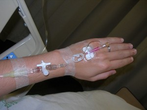 Iv in a hand, 20 gauge peripheral IV