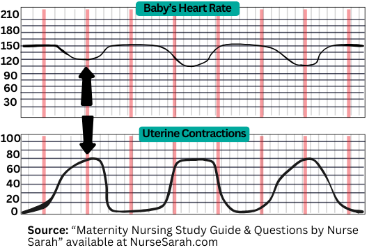 fetal heart rate monitoring, early decelerations, nursing, nclex