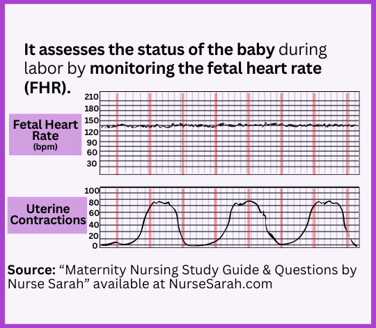 fetal heart rate monitoring, accelerations, decelerations, early, late, nursing, nclex