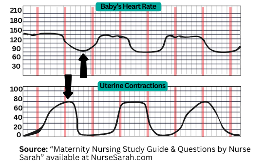 fetal heart rate monitoring, variable decelerations, nursing, nclex