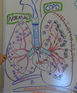 copd-lung