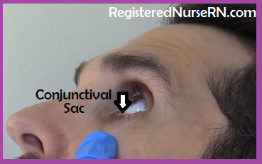 instill eye drops, conjunctival sac