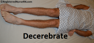 decerebrate posturing nursing nclex