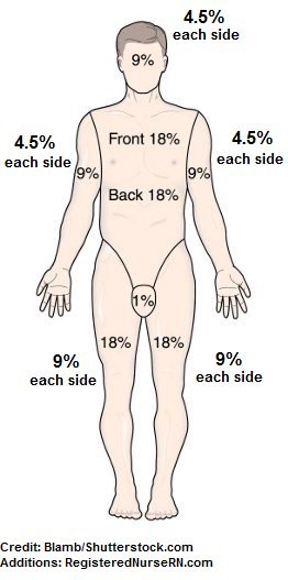 Burn Area Chart
