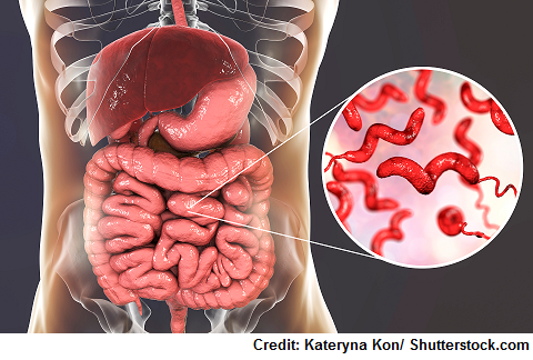 Guillain-Barre Syndrome, gbs, Campylobacter jejuni