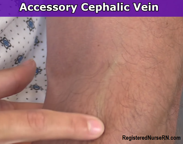 accessory cephalic vein, iv, draw blood, nursing