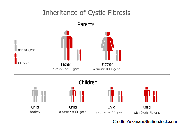 cystic fibrosis, cf, nursing, nclex, review