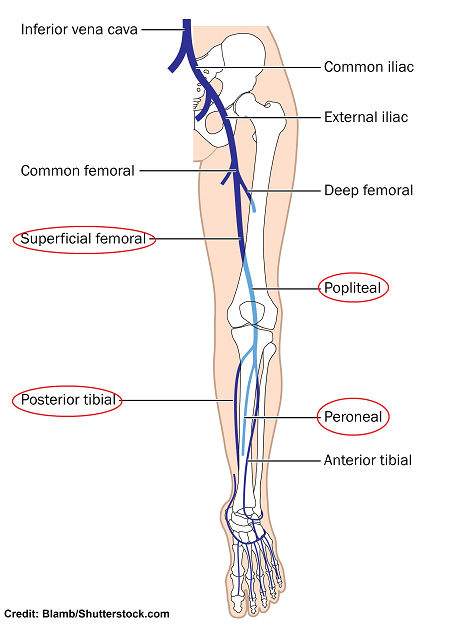 veins in the leg, dvt, deep vein thrombosis, blood clots