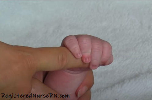 palmar grasp, reflex, nursing, nclex, pediatrics