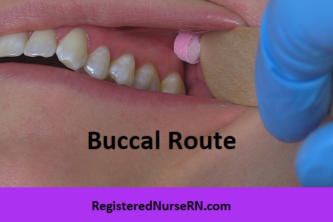 buccal administration, buccal route, buccal medication, sublabial, medication administration nursing, nursing