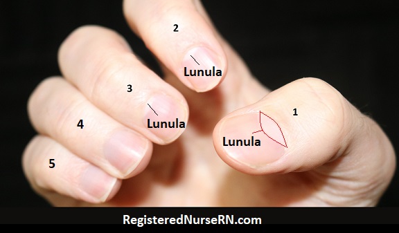 lunula, lunulae, lunula thumb, lunula hand, lunula nail anatomy, nail anatomy, germinal matrix
