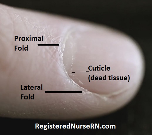 proximal fold, lateral fold, cuticle, nail anatomy, anatomy and physiology