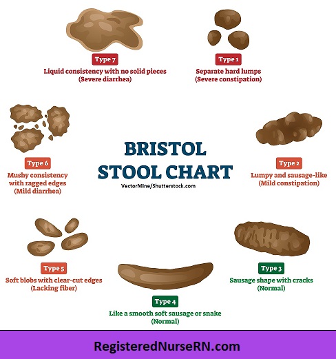 toddler constipation, bristol stool chart, stool consistency, constipation