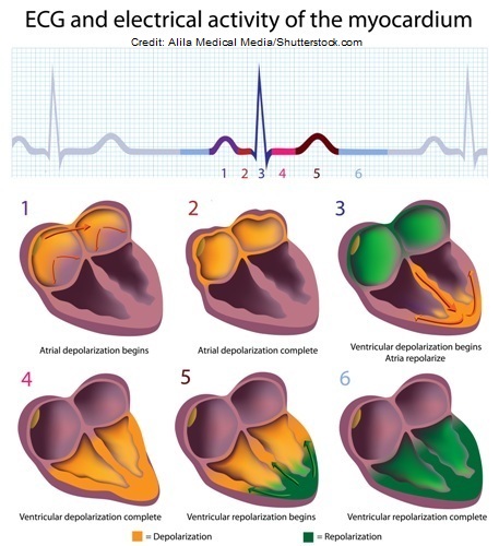 ecg, ekg interpretation, atrial depolarization, repolarization ventricular, pqrst