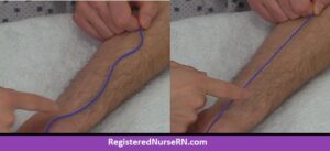 how to anchor veins, venipuncture, vein tension, stop rolling veins, vein moves, start iv, nursing, phlebotomy
