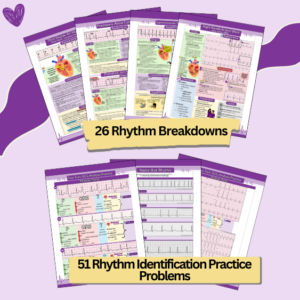 ecg study guide, ekg workbook, ecg interpretation, ekg interpretation, analzying heart rhythms, nurse sarah notes, nurse sarah bundle