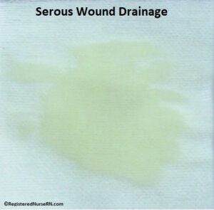 serous, serous wound drainage, serous drainage color, wound drainage nursing, wound drainage nclex, nursing, nursing school,