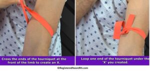 how to tie a tourniquet, tourniquet tying, tying a tourniquet, nursing, phlebotomy, nursing school