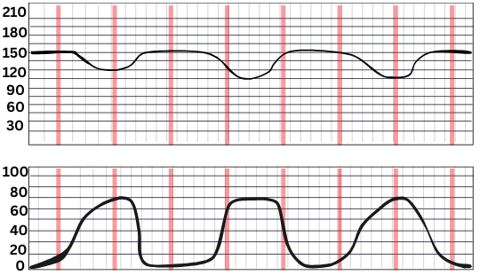  Fetal Heart Rate Tone Monitoring Quiz